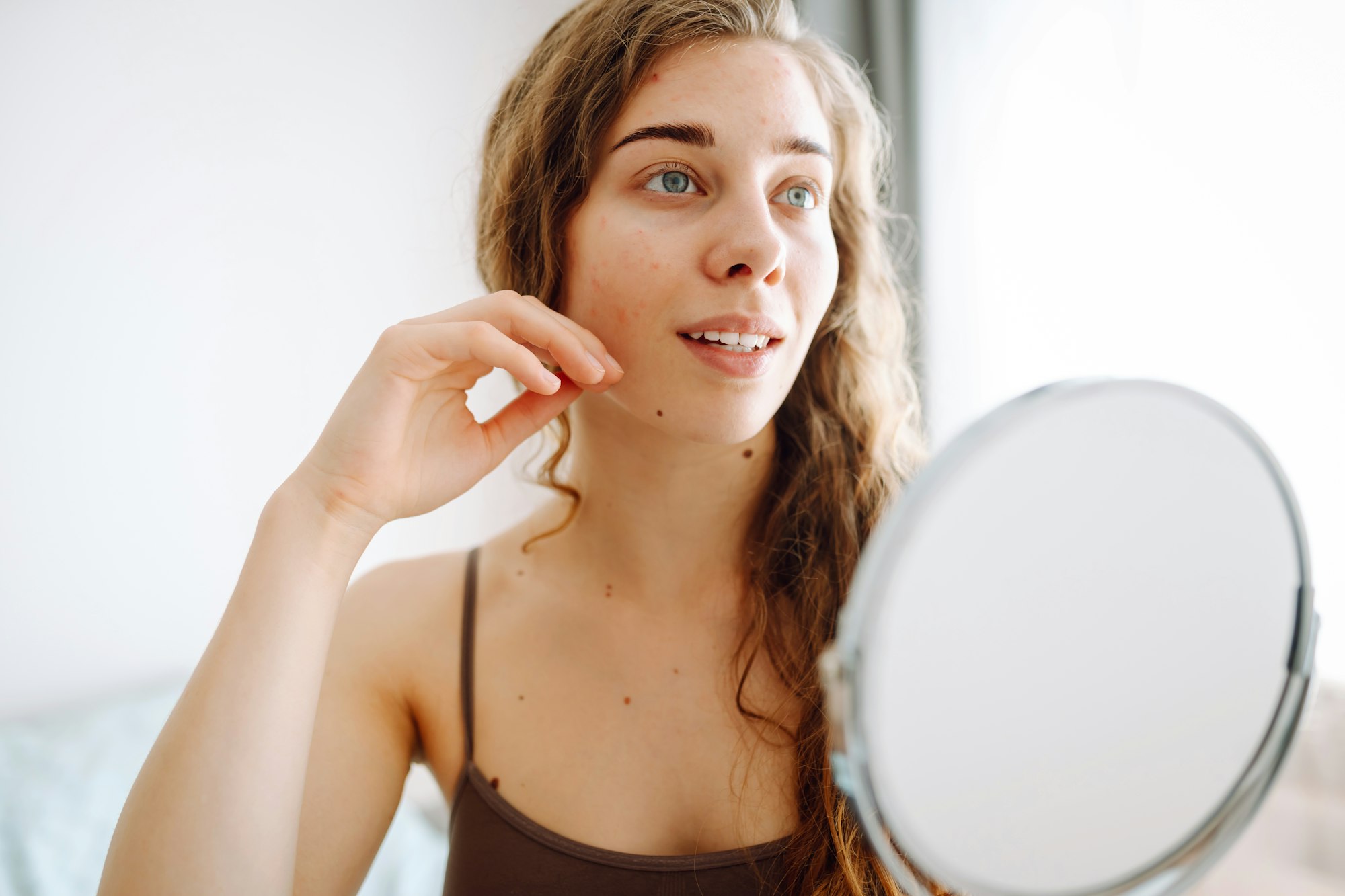 Close-up of a cute woman with problem skin looking in the mirror. Dermatology concept, allergy.
